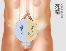 人到中年治愈死精症
