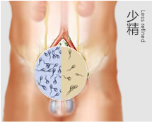 二轻为您解决3年不育之恼