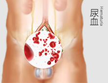 无法想象我也居然会尿血