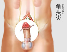 二轻解除了我的瘙痒烦恼