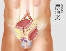 一时糊涂，淋病缠身