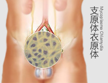 呼和浩特治疗男性感染疾病成功案例